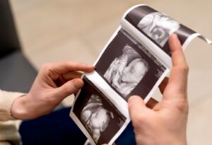 probiotiquet et prébiotique bébé