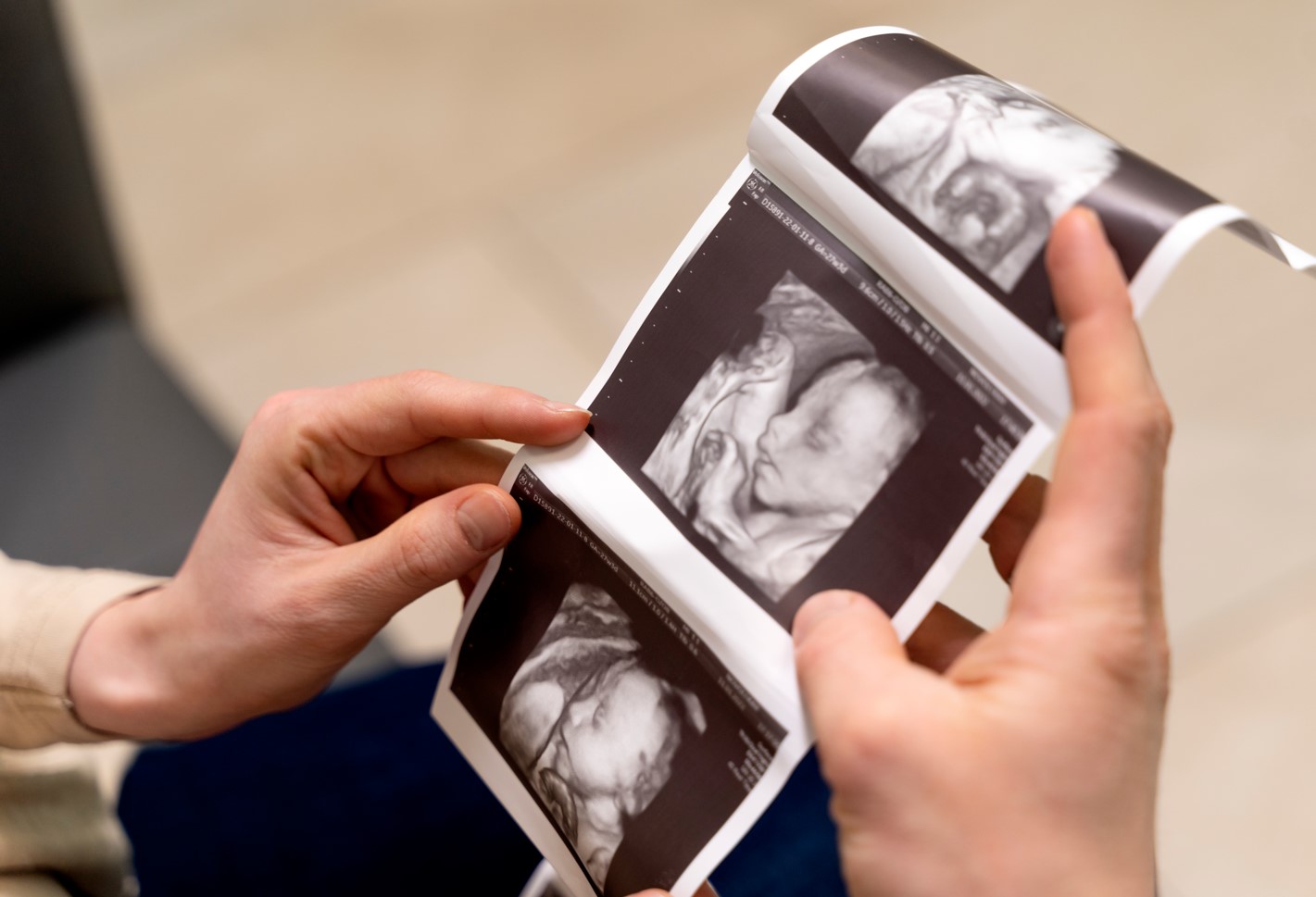 probiotiquet et prébiotique bébé