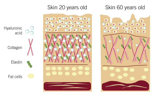 le collagene et les rides