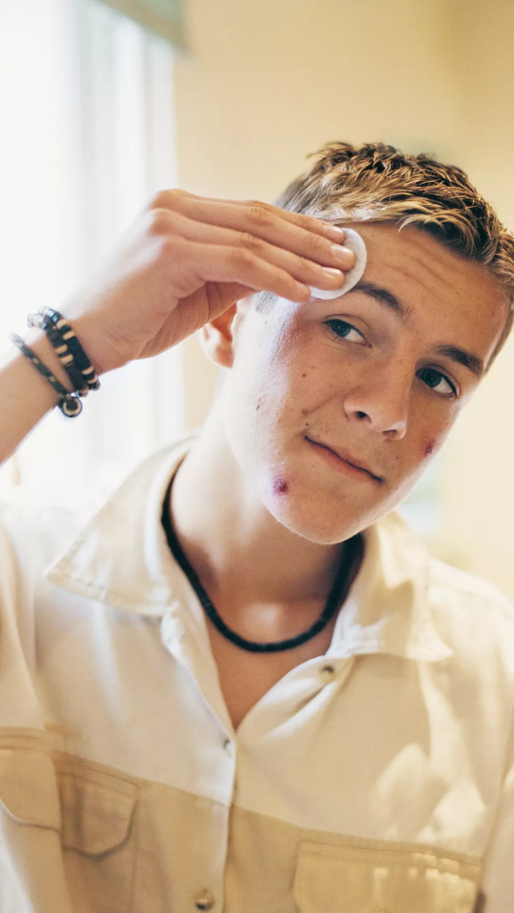 Acné digestive ventre